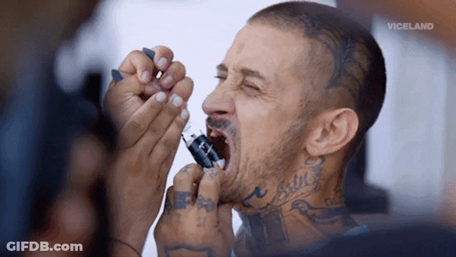 Funny Man With Missing Teeth Gets Another Tooth Removal GIF