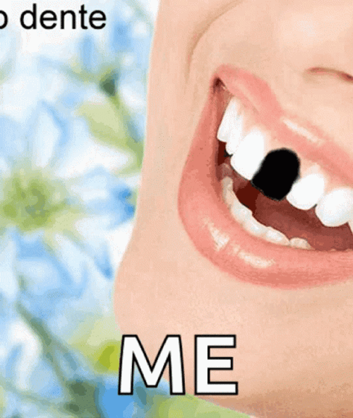 Funny Me Teeth Removal GIF