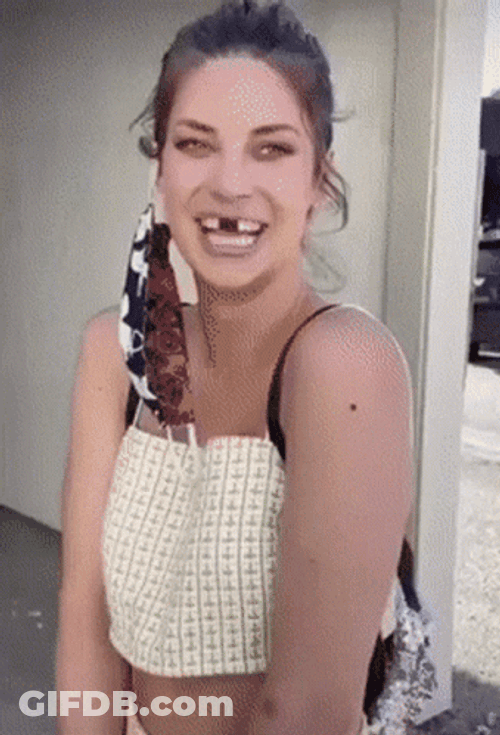 Funny Missing No Teeth GIF