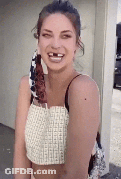 Funny Scam Teeth GIF