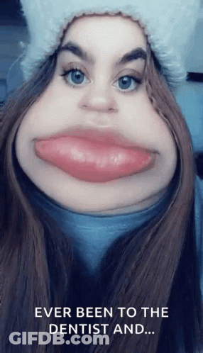 Funny Woman Saying Ever Been To Dentist And GIF