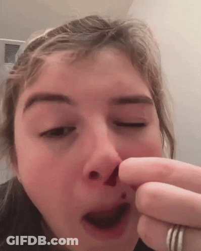 Girl Holding Nose With Blood GIF