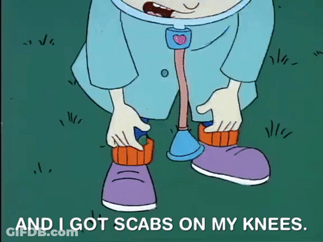 Got Scabs On My Knees GIF