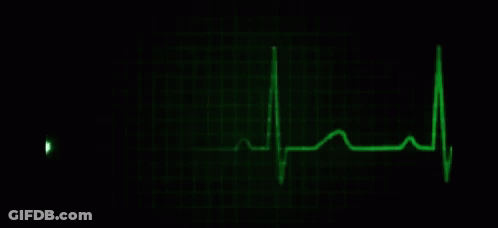Green Heartbeat Monitor With Heartbeat Line GIF