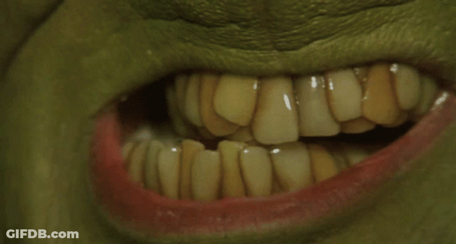 Grinch Infected British Teeth GIF