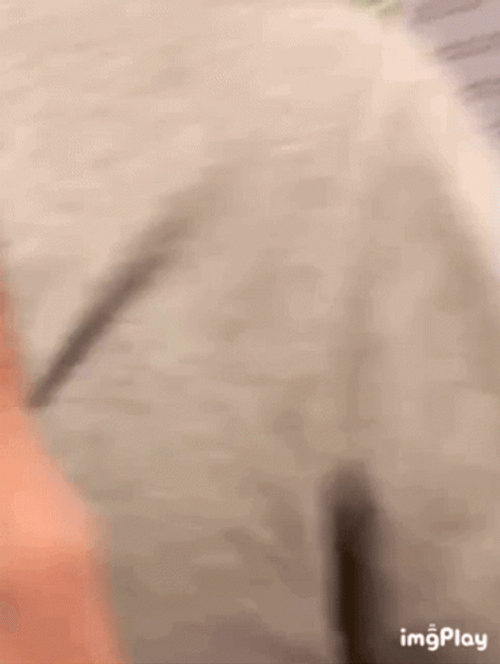 Guy With Hickey Marks GIF