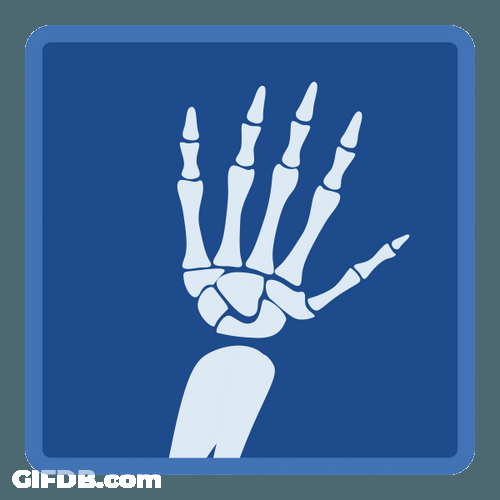 Hand Bones X Ray Effect Animation GIF