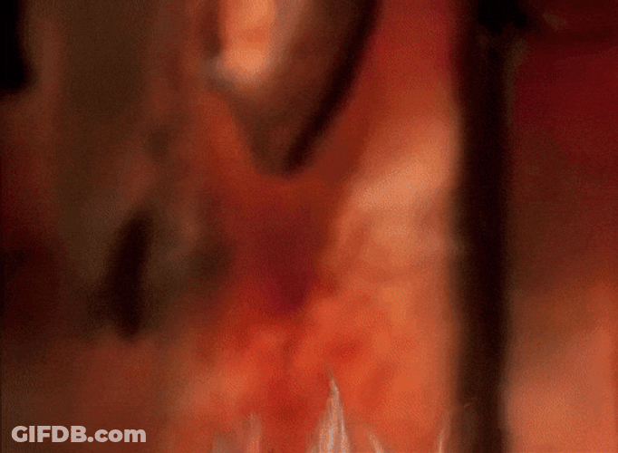Heat Miser With Glowing Hair GIF