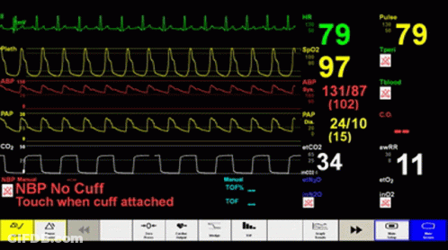 Hospital Monitor GIF