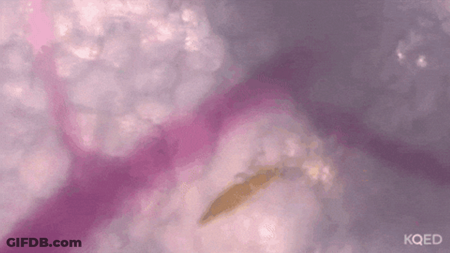 How To Bite Mosquito GIF