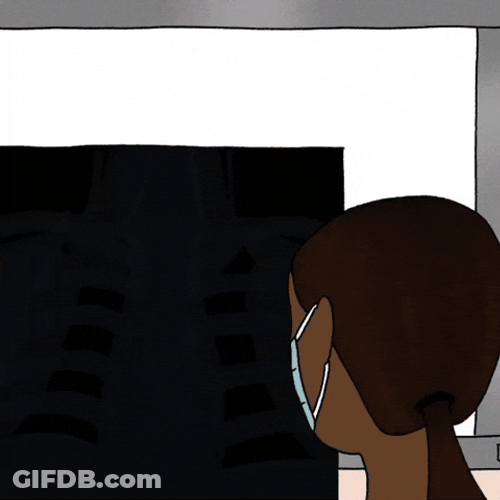 Human Ribs X Ray GIF