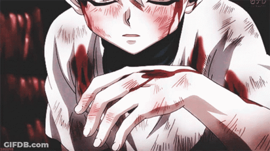 Hunter X Hunter Injured Killua GIF