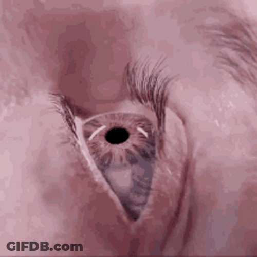 Insect Crawling Into The Eyeball GIF