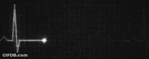 It Is A Black And White Image Of A Heartbeat . GIF
