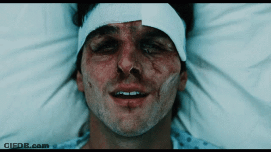 Jacob Elordi Smiling Beat Up Face Close Up GIF