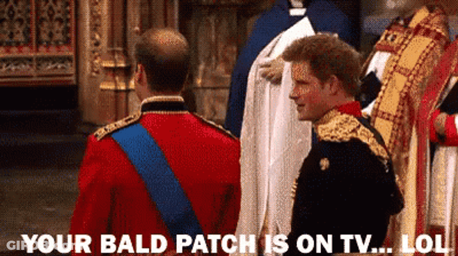 Joke Over Head Prince Harry Meme GIF
