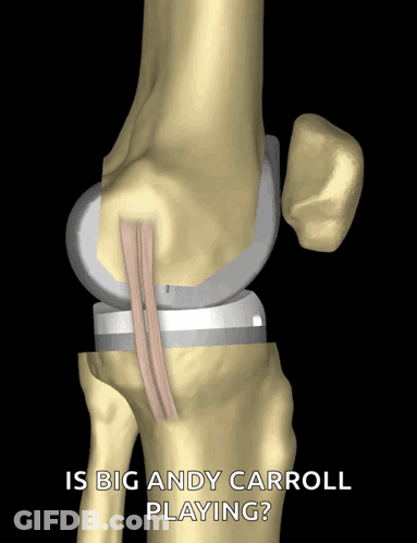 Knee Saying Is Big Andy Carroll Playing GIF
