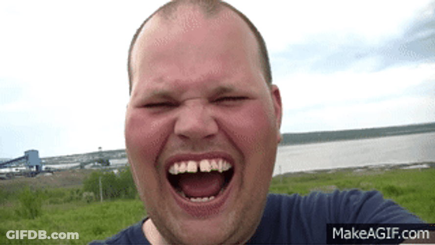 Laughing Hard Show Off Teeth GIF