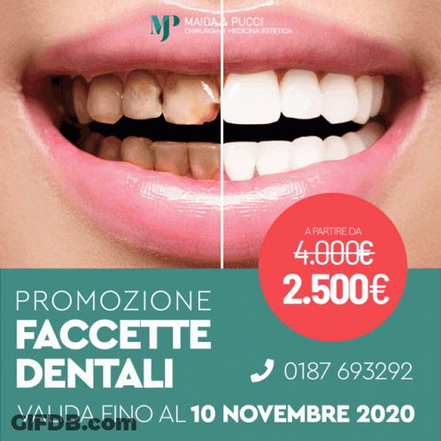 Maida & Pucci Before And After Teeth Advertisement GIF