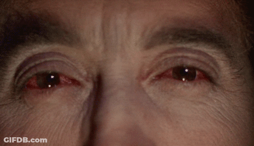 Man Having Red Eyes GIF