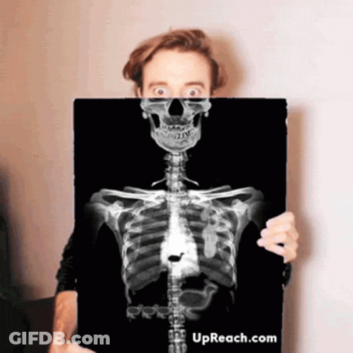 Man Holding X-Ray Skeleton With Upreach.com GIF