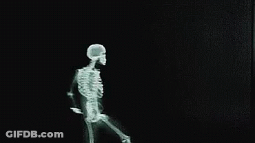 Man Looking At X-Ray Of Skeleton GIF