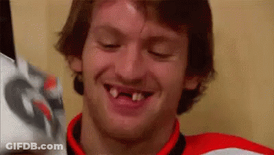 Man Missing Teeth Smiling Holding Hockey Helmet GIF