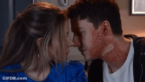 Man With Bandage Kissing Woman In Blue Dress GIF
