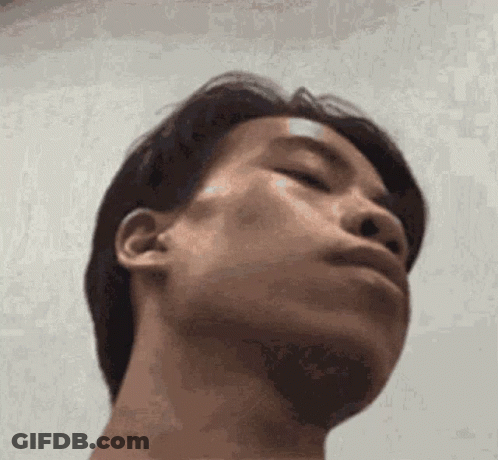 Man With Bandage On Forehead Looking At Camera GIF