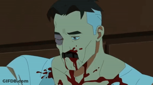 Man With Blood On Face I Miss My Wife GIF
