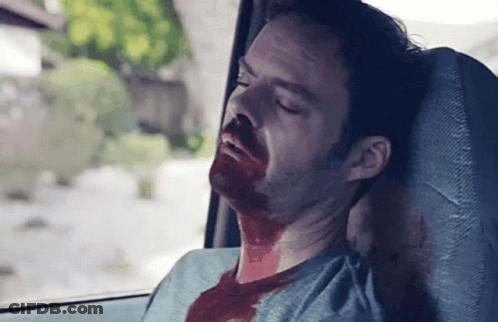 Man With Blood On Face Laying In Car GIF