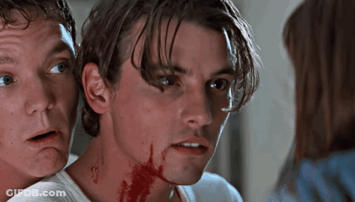 Man With Blood On Neck Looks At Camera GIF