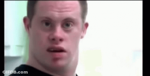 Man With Down Syndrome Making Funny Face GIF