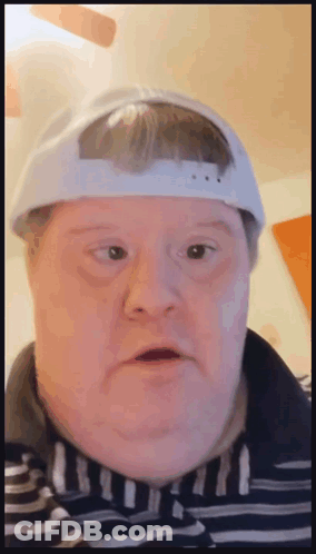 Man With Down Syndrome Wearing White Hat And Striped Shirt GIF