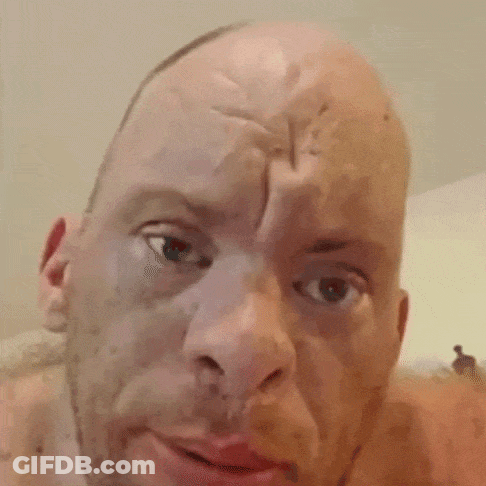 Man With Huge Bump On Head GIF