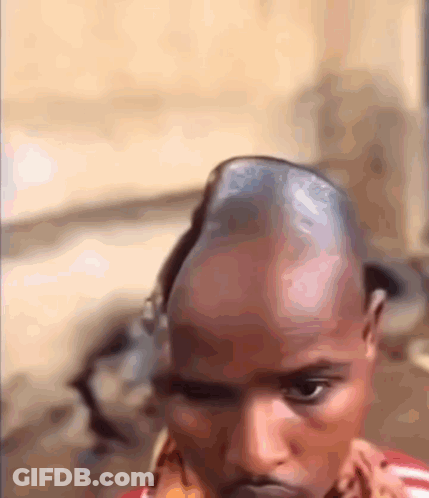 Man With Large Bump On Head GIF