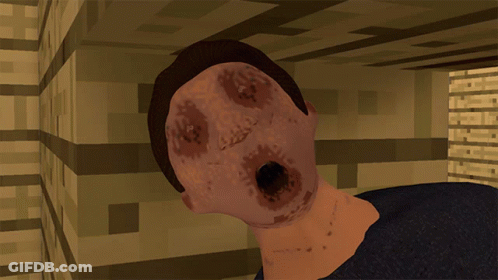Man With Large Eye GIF