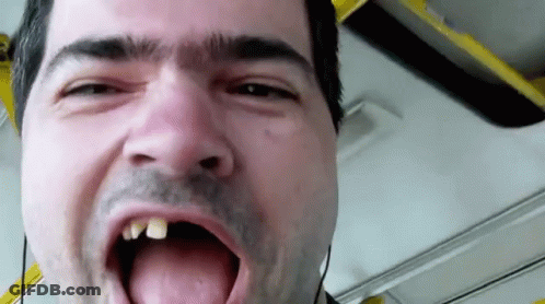 Man With Missing Tooth Wearing Headphones Making Funny Face GIF
