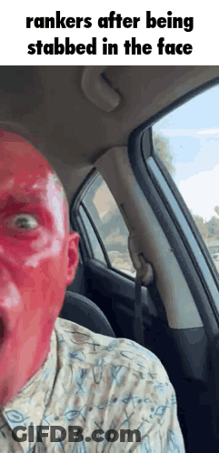 Man With Red Spots In Car Saying Rankers GIF