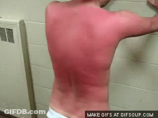 Man With Red Spots Standing GIF