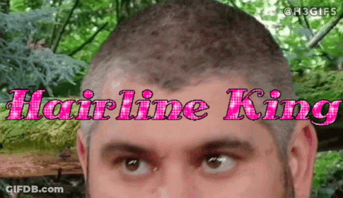 Man With Shaved Head Saying Hairline King GIF