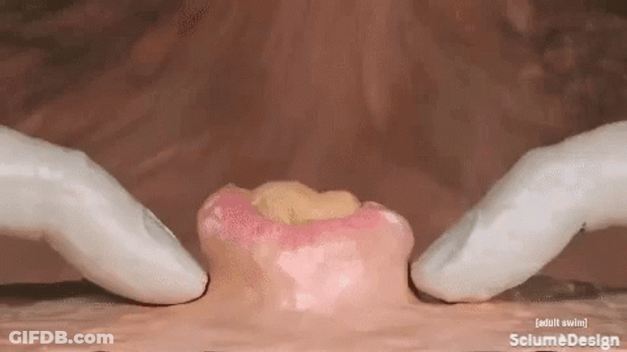 Massive Pimple Person Popping Out Clay Animation GIF