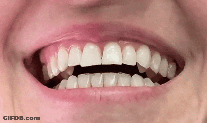 Perfect Smile Teeth GIF