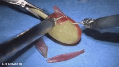 Person Cutting Grape With Scissors On Blue Table GIF