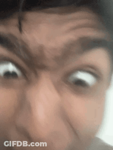 Person Making Funny Face With Eyes Wide Open GIF