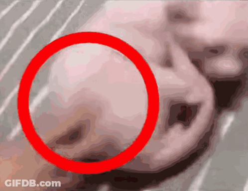 Person With Red Circle Around Nose GIF