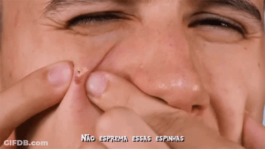 Pimple Popping Head Peeking Out Meme GIF