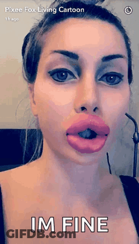 Pixee Fox With Huge Pink Lips GIF