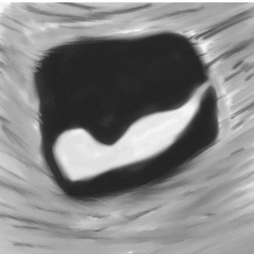 Pregnancy Baby Fetus Womb Art GIF