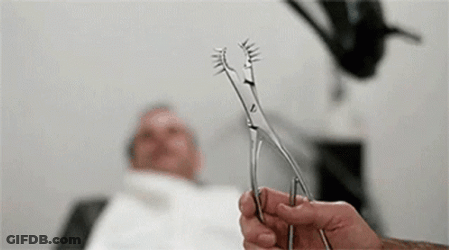 Pulling Teeth Using A Spiky Tool GIF